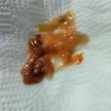 我が家の赤なまこの下処理となまこ酢 レシピ 作り方 By ここなっつん 楽天レシピ 我が家の赤なまこの下処理となまこ酢 レシピ 作り方 By ここなっつん 楽天レシピ